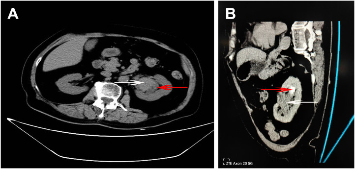 Figure 1