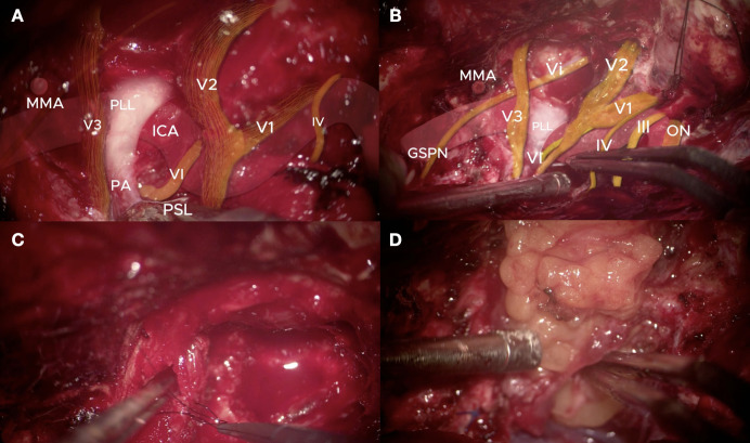 Figure 3
