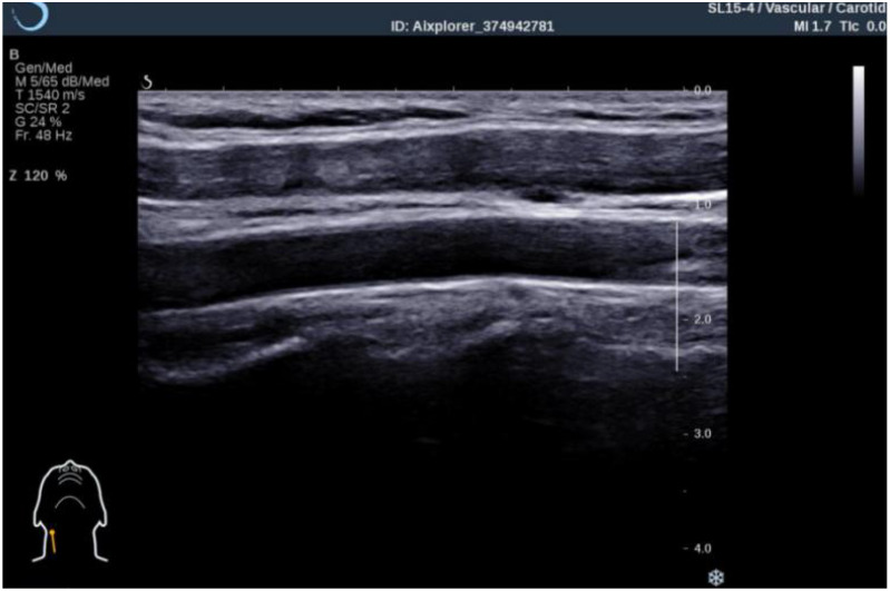 Figure 1