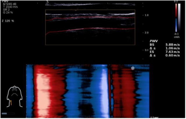 Figure 2