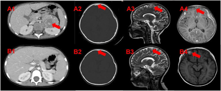 Figure 1