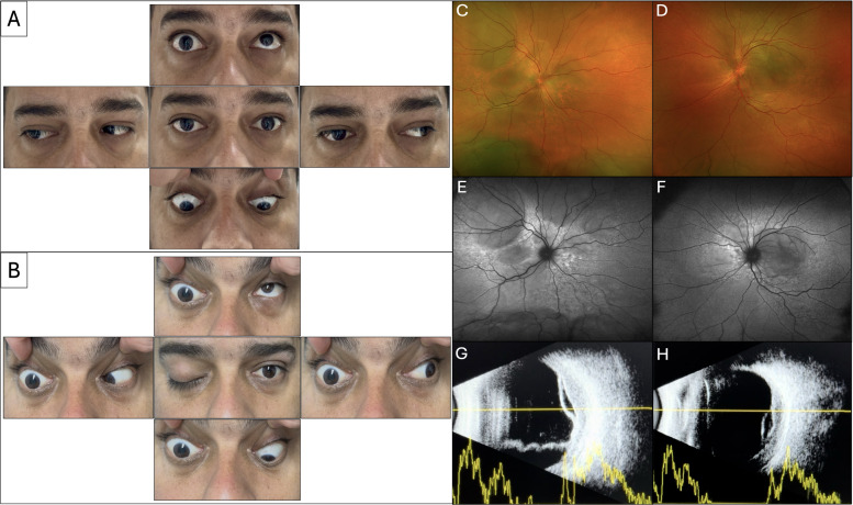 Figure 1