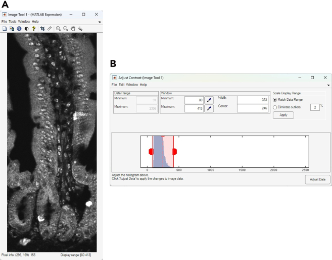 Figure 11
