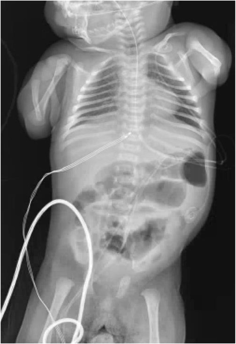 Figure 1