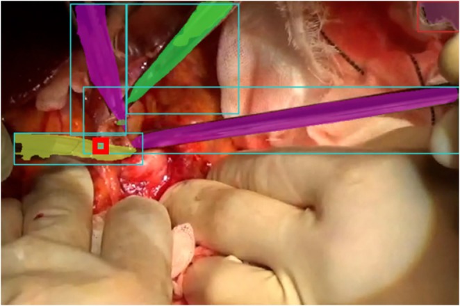 FIGURE 3