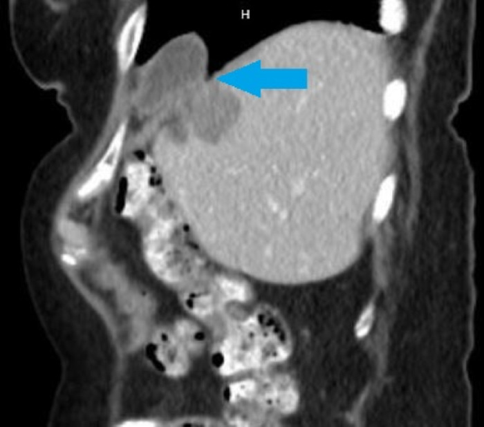 Figure 1