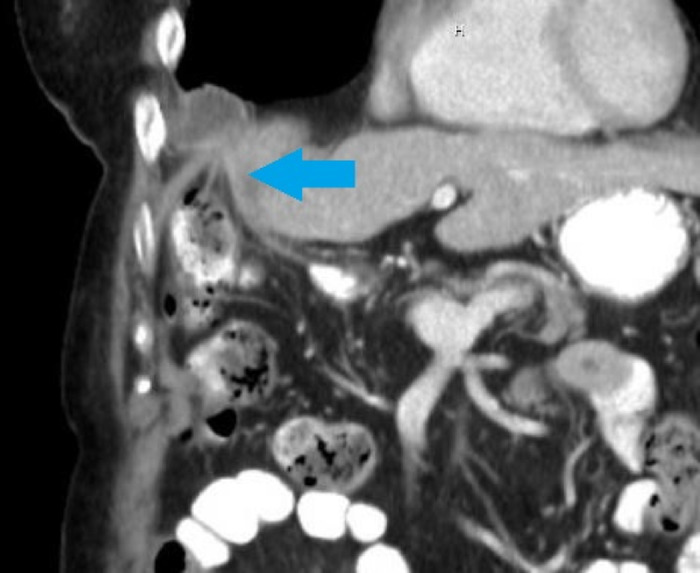 Figure 2