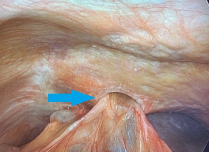 Figure 3