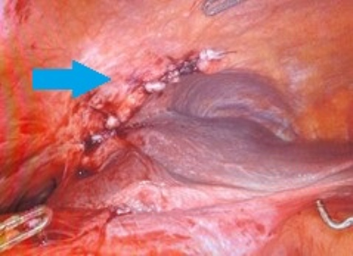 Figure 6