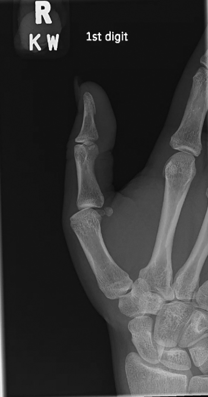 Figure 1