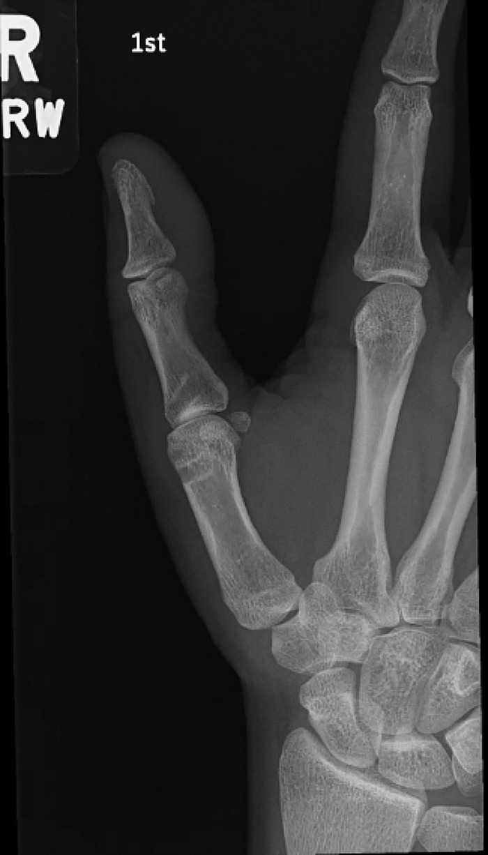 Figure 3