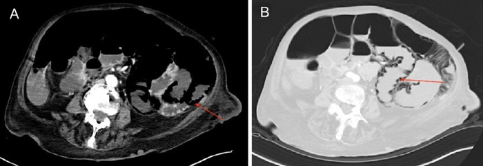 Figure 1