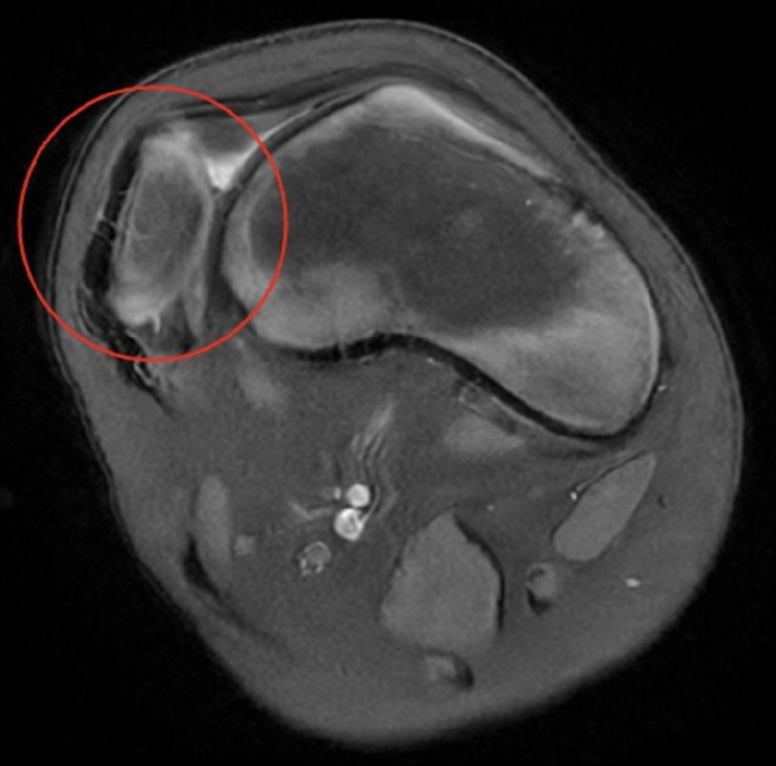 Figure 1