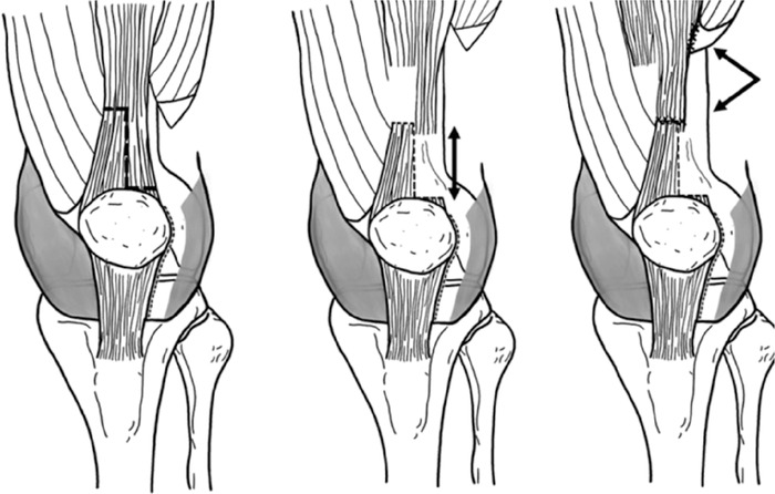 Figure 13