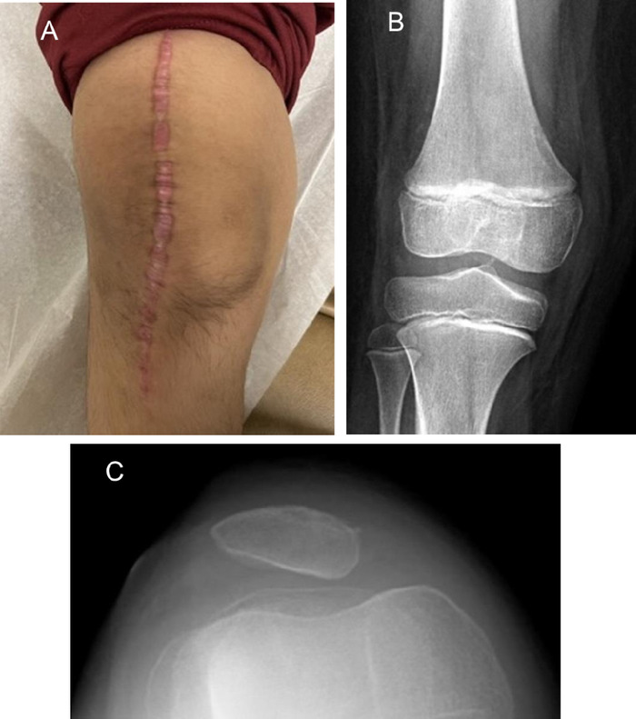 Figure 17