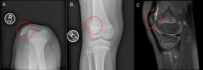 Figure 3