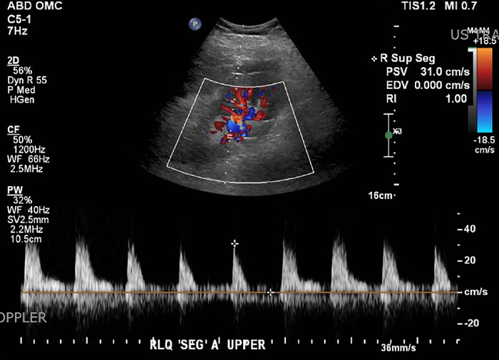 Figure 1