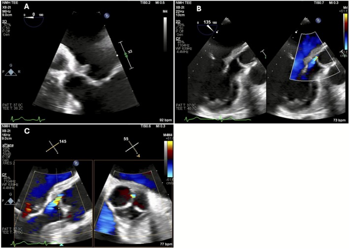 FIGURE 1