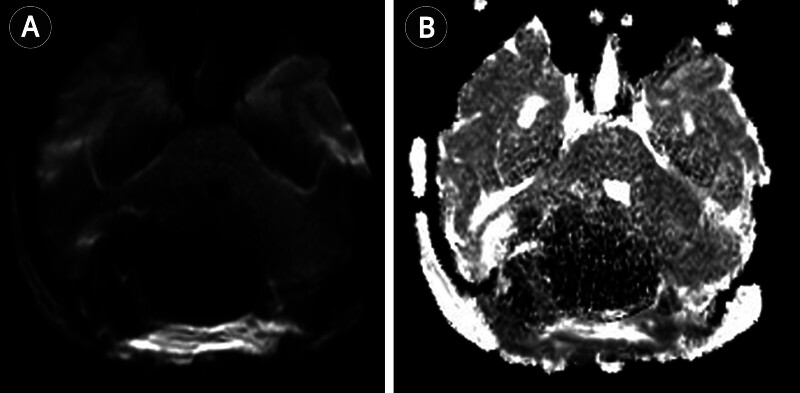 Fig. 5