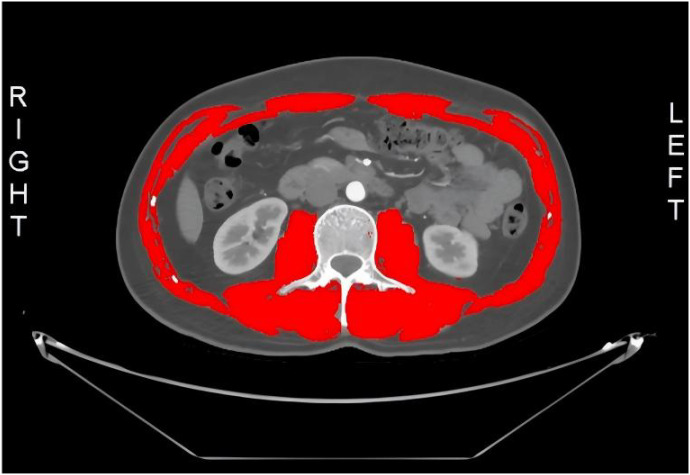Figure 1