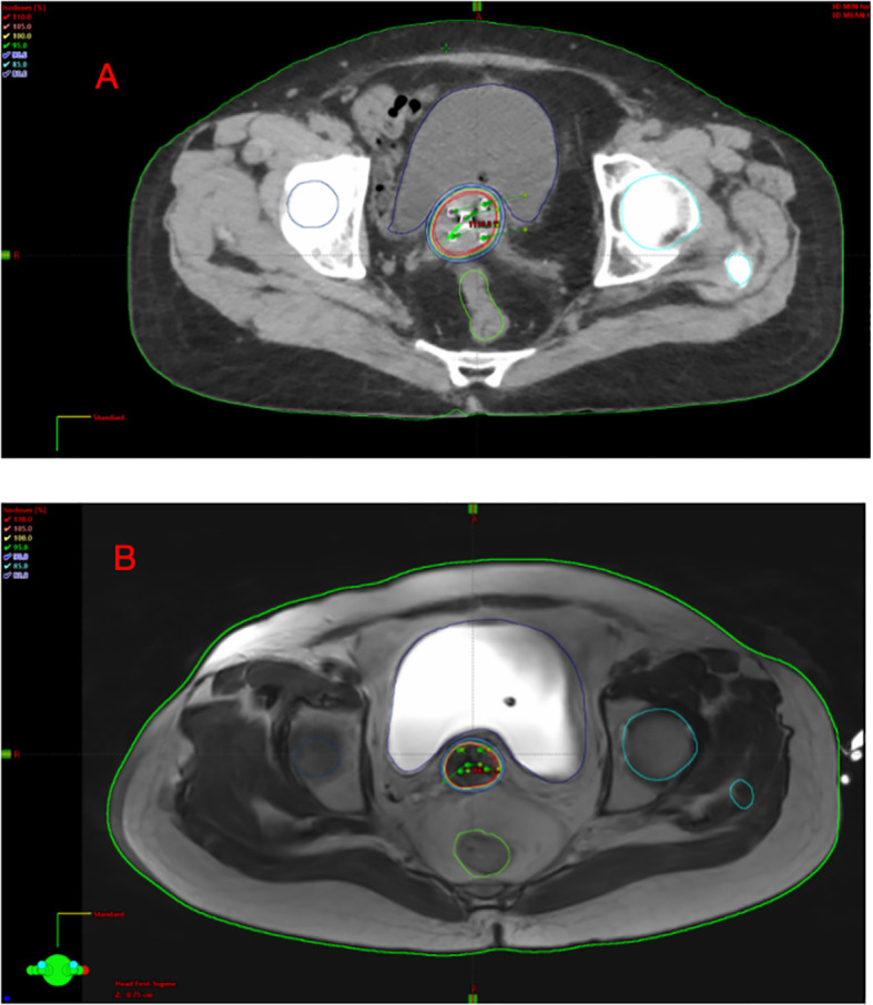 Figure 2