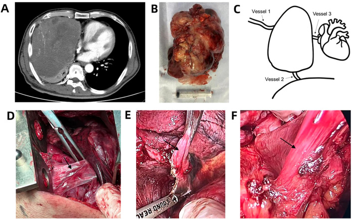 Figure 1