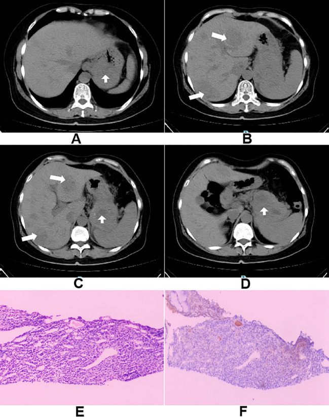 Figure 1