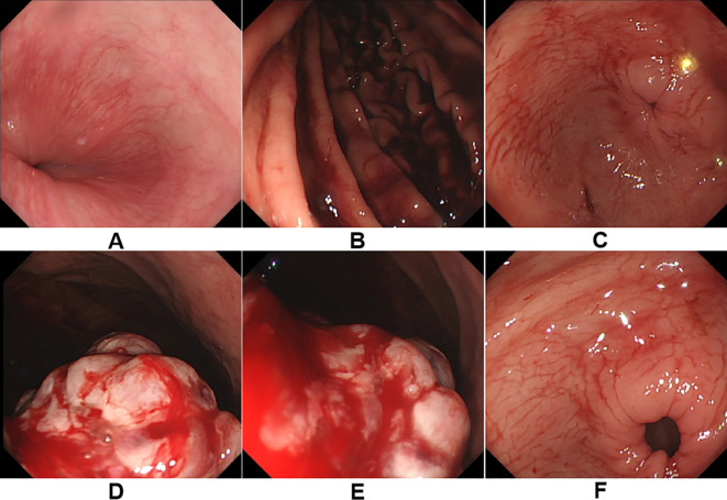 Figure 2