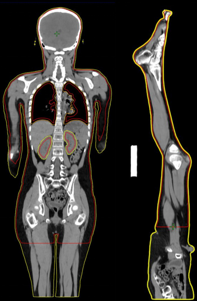 Figure 2