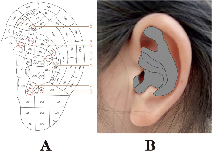 Figure 13