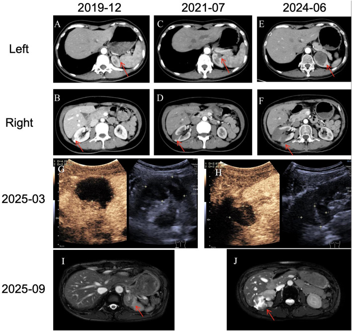 Figure 2