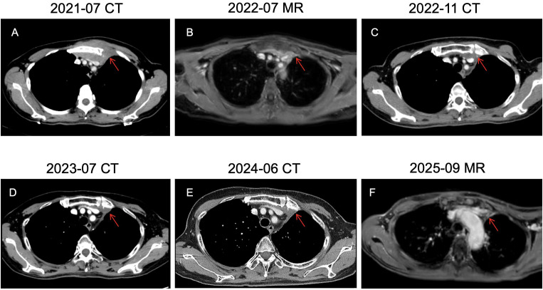 Figure 3