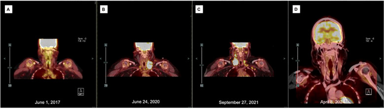 Figure 2