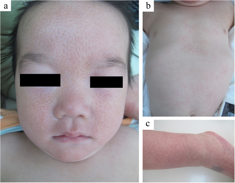 Figure 1