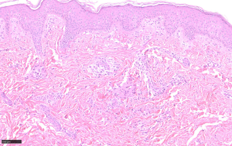 Figure 2