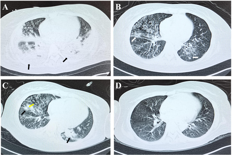 Figure 3