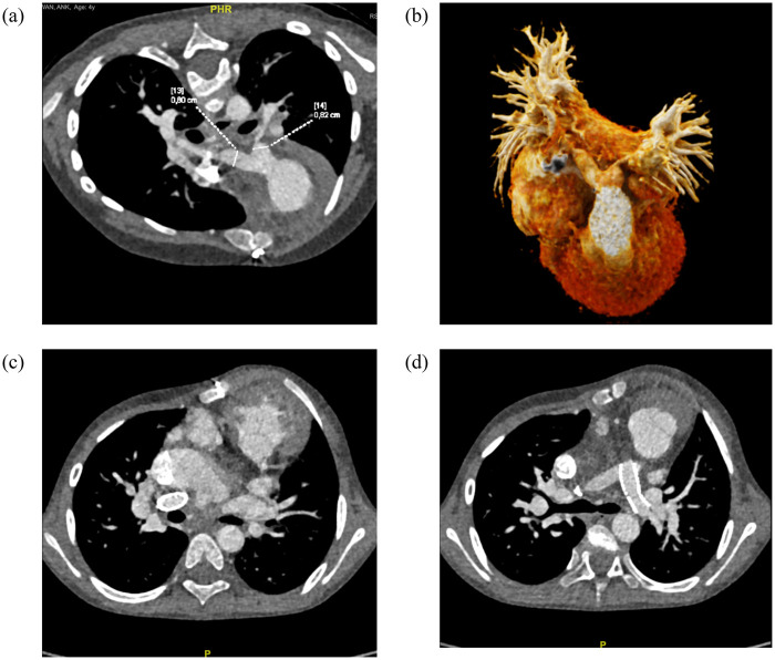 Figure 2