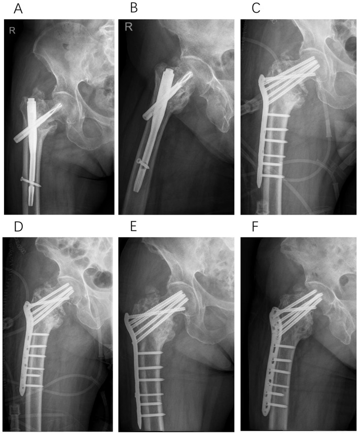 Figure 4