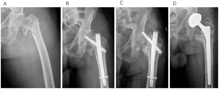 Figure 6