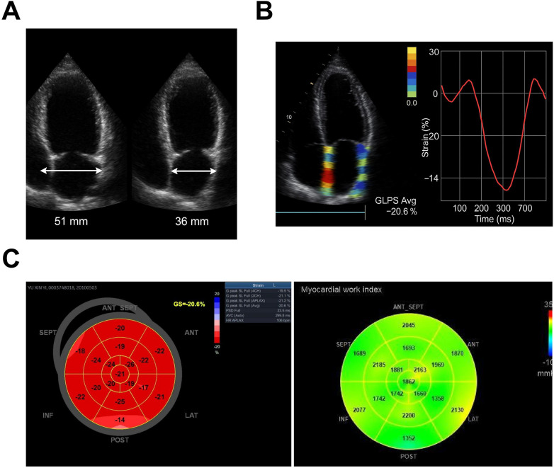 Figure 2