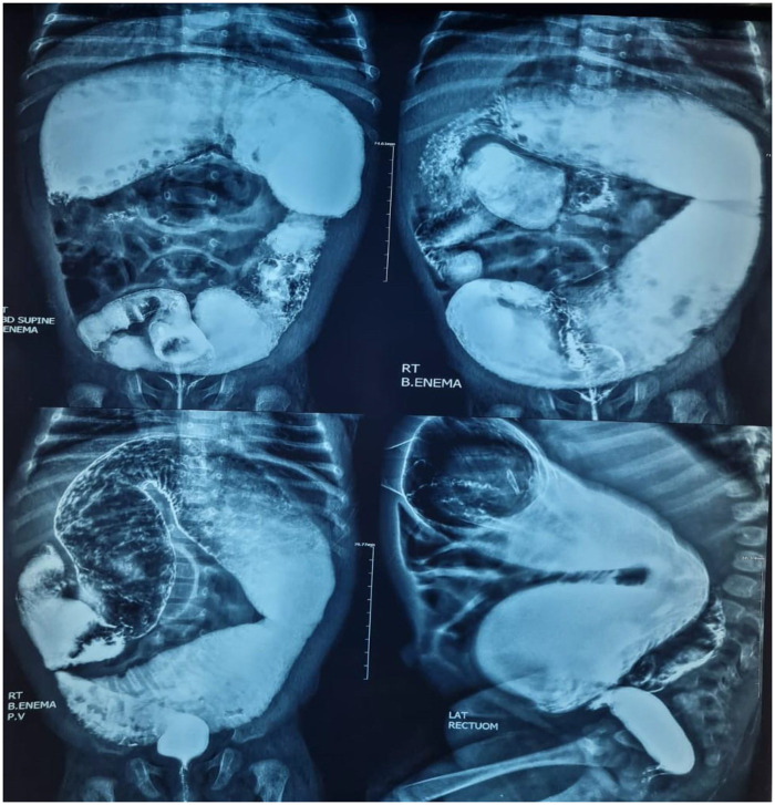 Figure 1