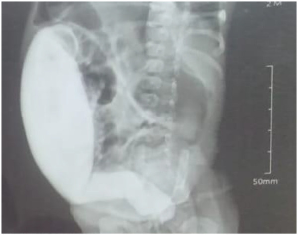 Figure 2