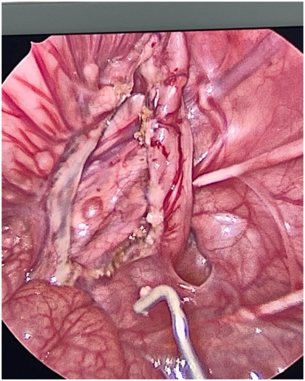 Figure 4