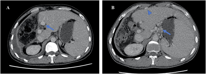 Figure 10