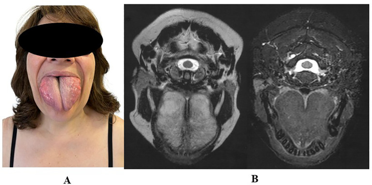 Figure 3