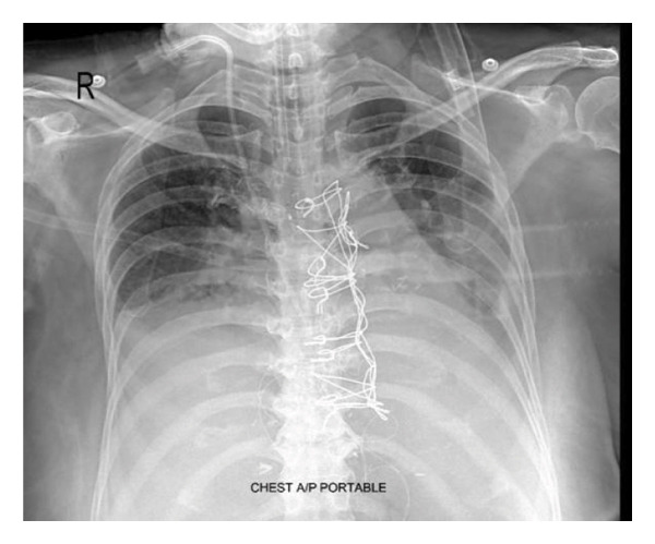 FIGURE 1