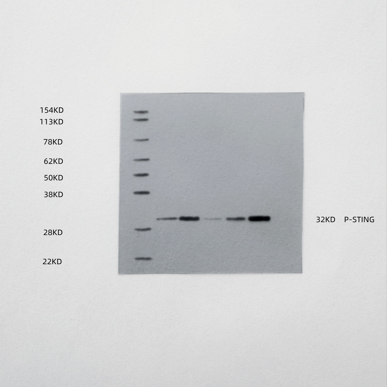 Figure 15