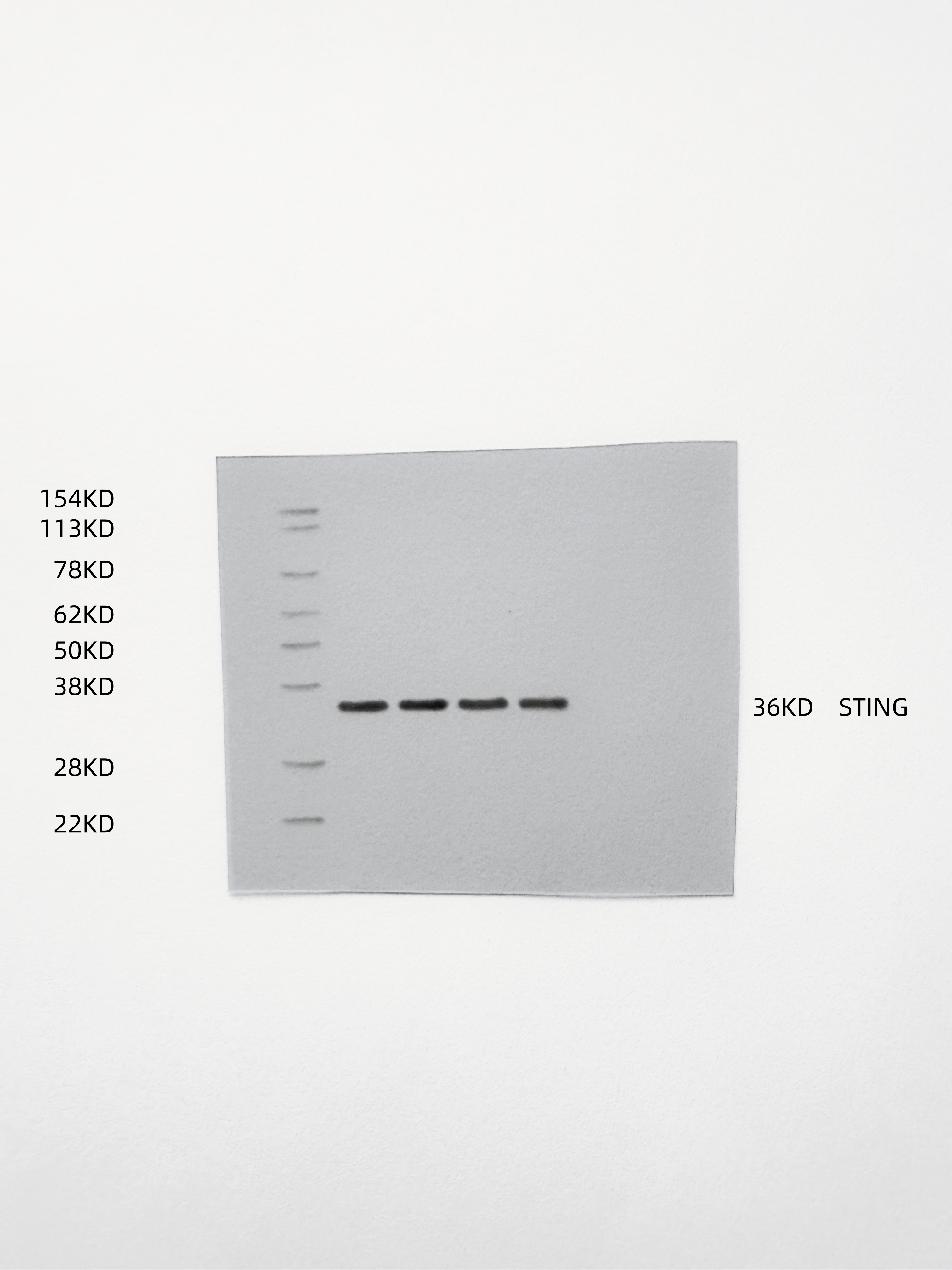 Figure 18