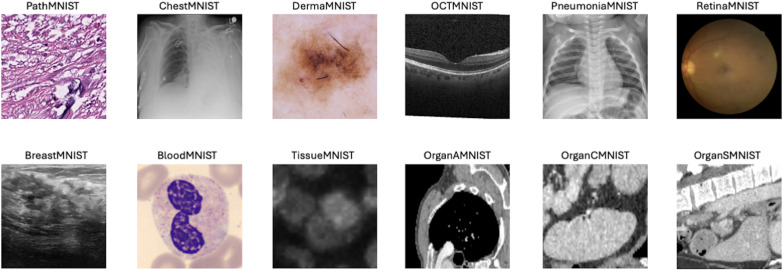 Figure 21