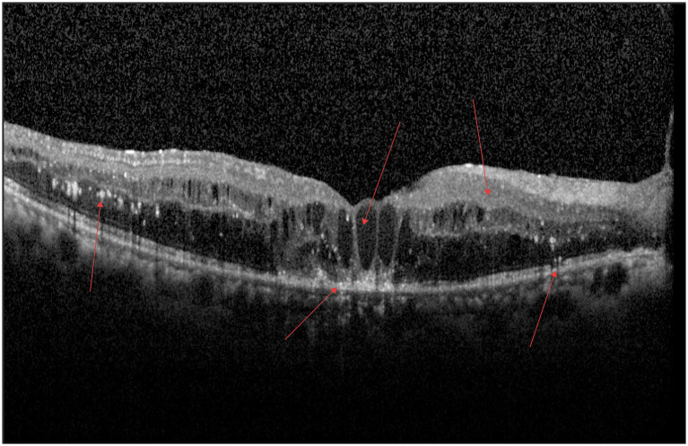 Figure 6